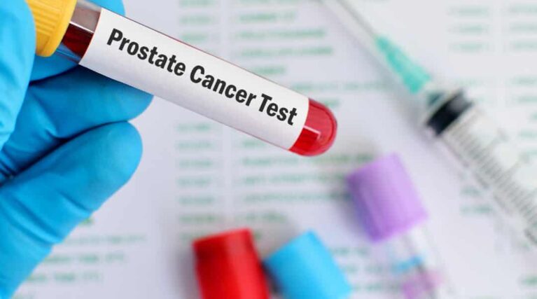 PSA Testing