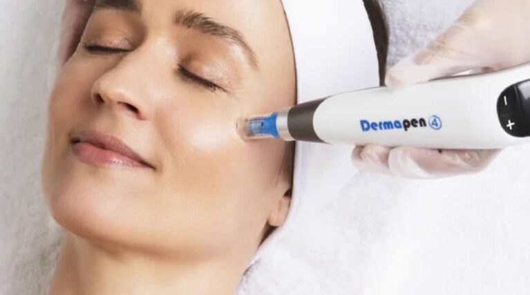 WEBSITE-Images-Square-VIE-96 Microneedling with Dermapen 4™