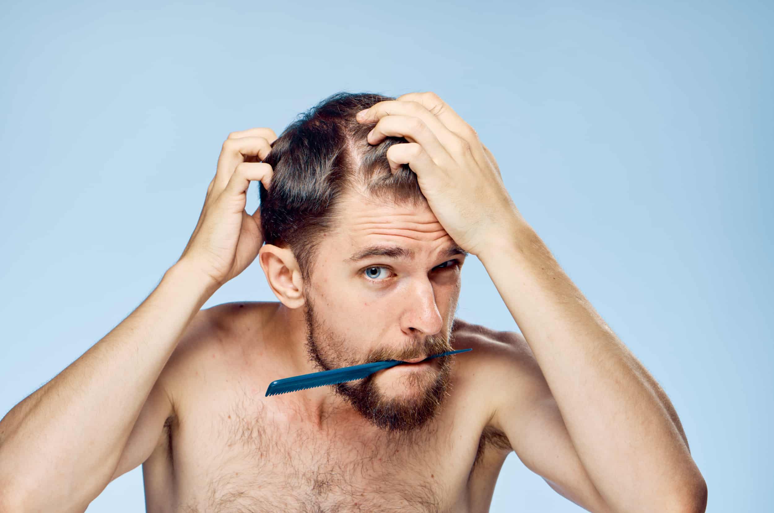 young man noticing early signs of hair loss