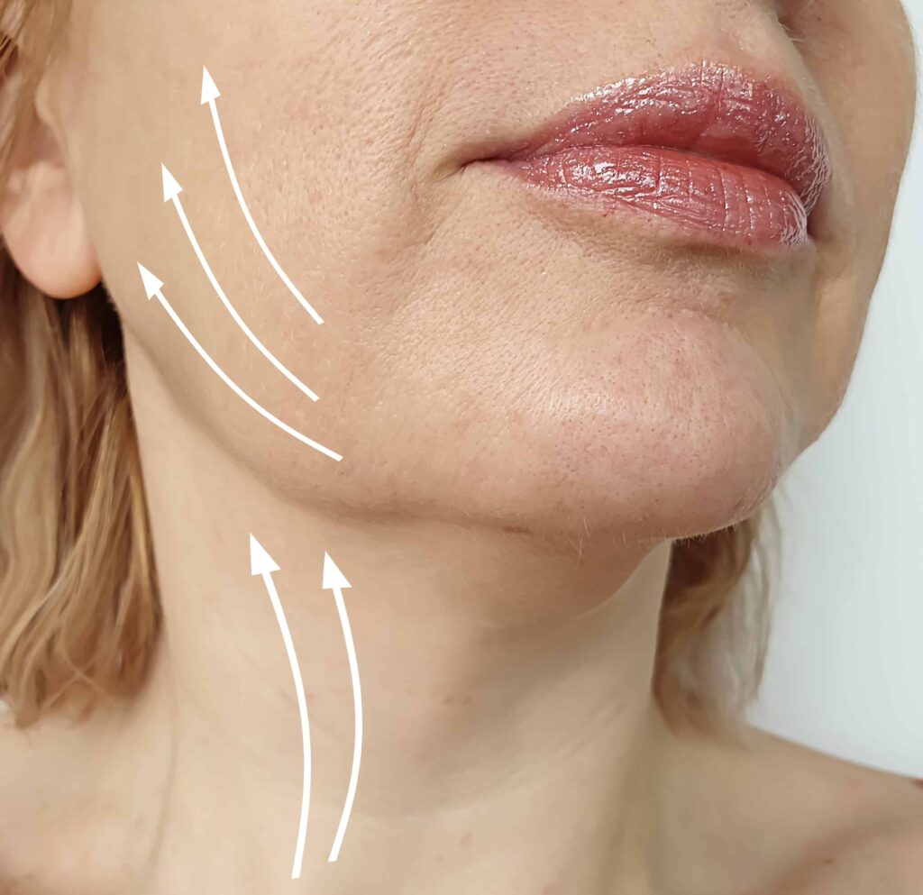 woman with jowls considers a non-surgical skin tightening procedure