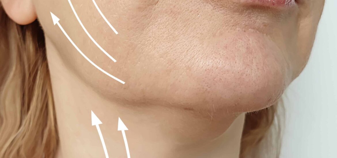 jowls-concern woman with jowls considers a non-surgical skin tightening procedure