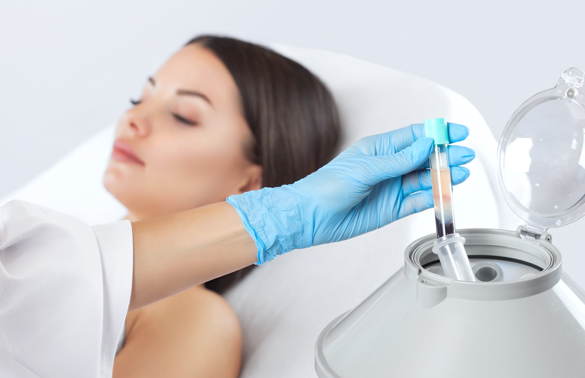 Platelet-Rich-Plasma (PRP) Therapy