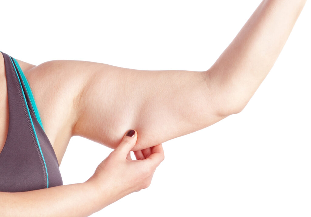 Woman showing her bingo wings caused by stubborn arm fat