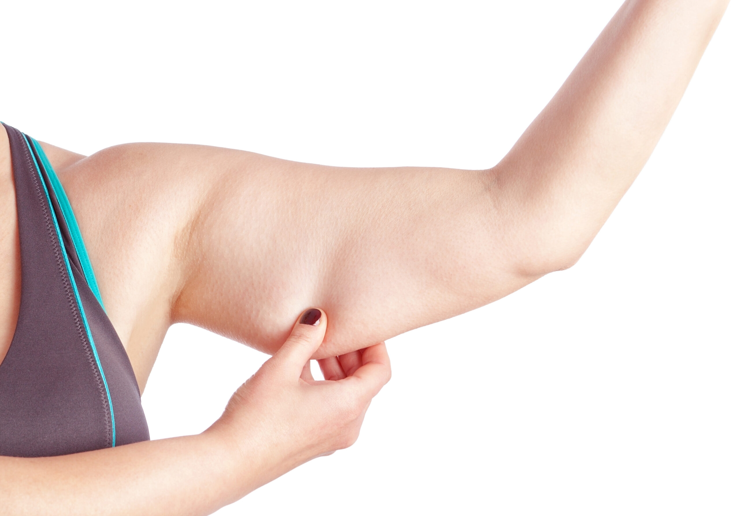 Woman showing her bingo wings caused by stubborn arm fat