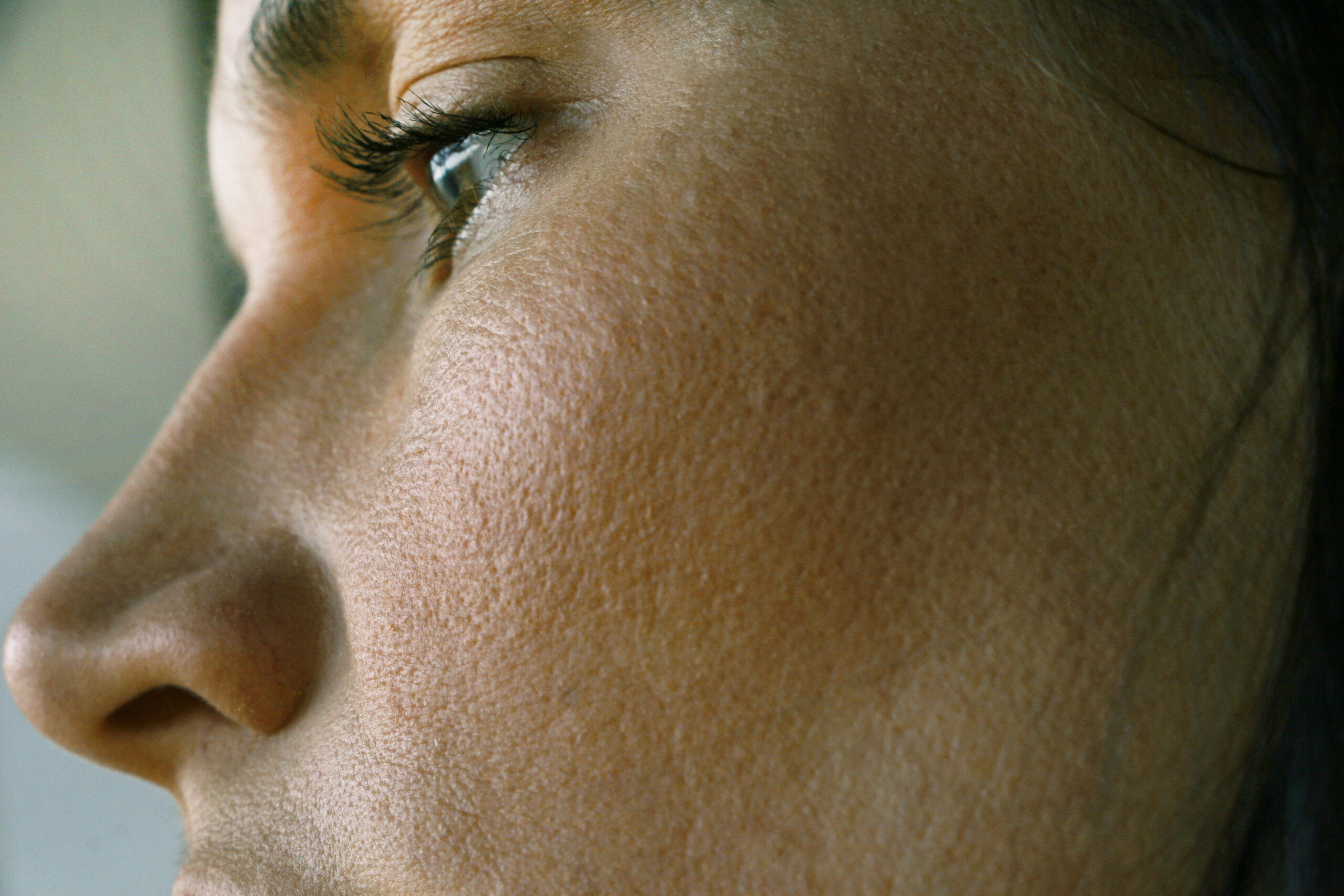 woman with large pores or open pores on their face