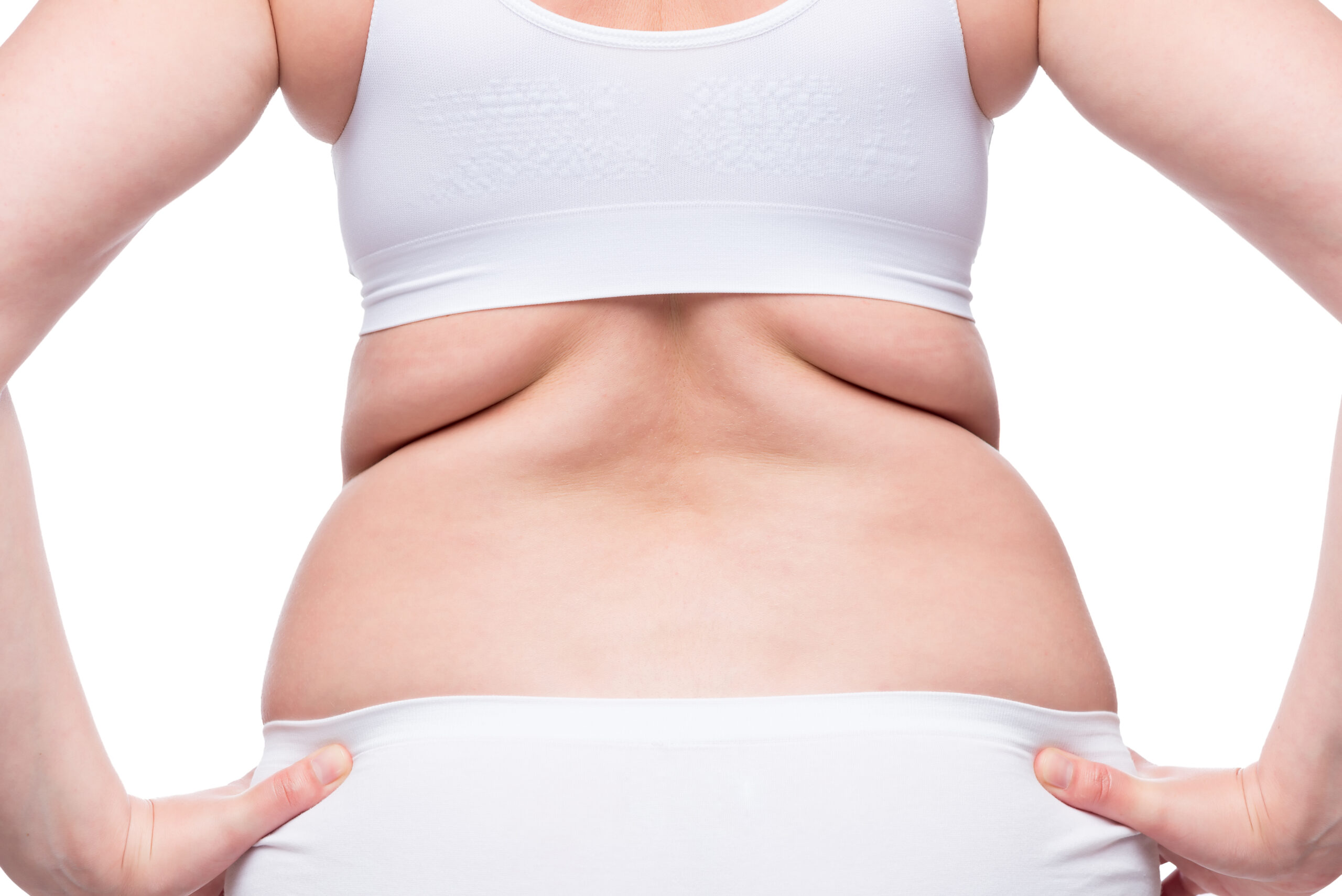 woman with pockets of fat on her back considers non-surgical body toning procedure