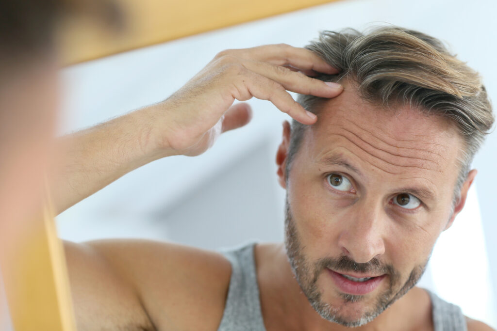 Hair Concerns