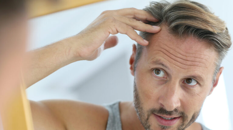 Regenera Activa Hair Loss Treatment