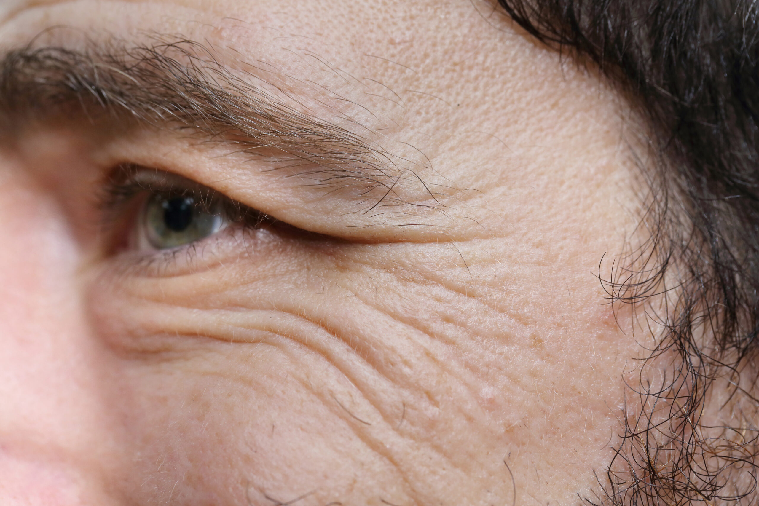 Crow's feet on a man caused by ageing or lifestyle